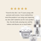 Wrinkle Smoothing, Hydrating Face Treatment Rosacea and Acne Prone Skin - Firming and Plumping EpiLynx